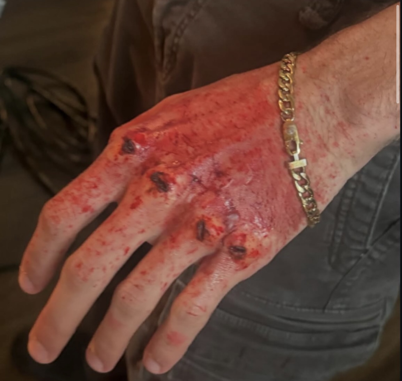 Practical Injury