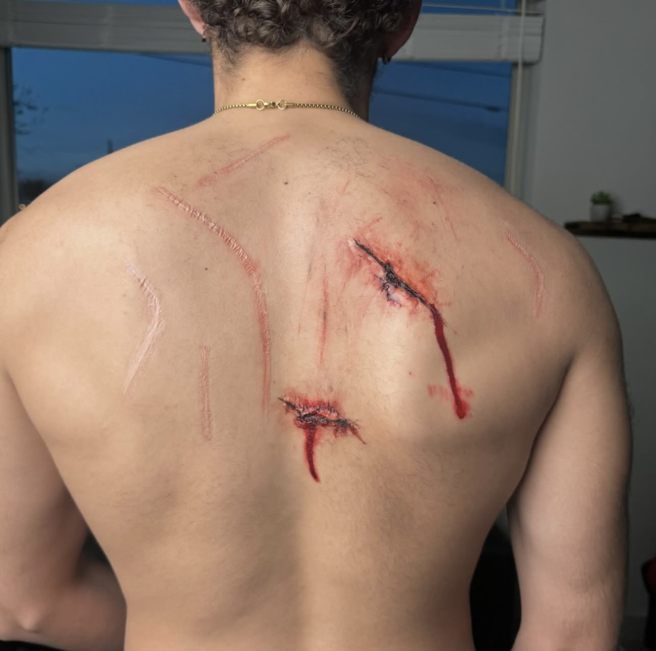 practical-injury-studies